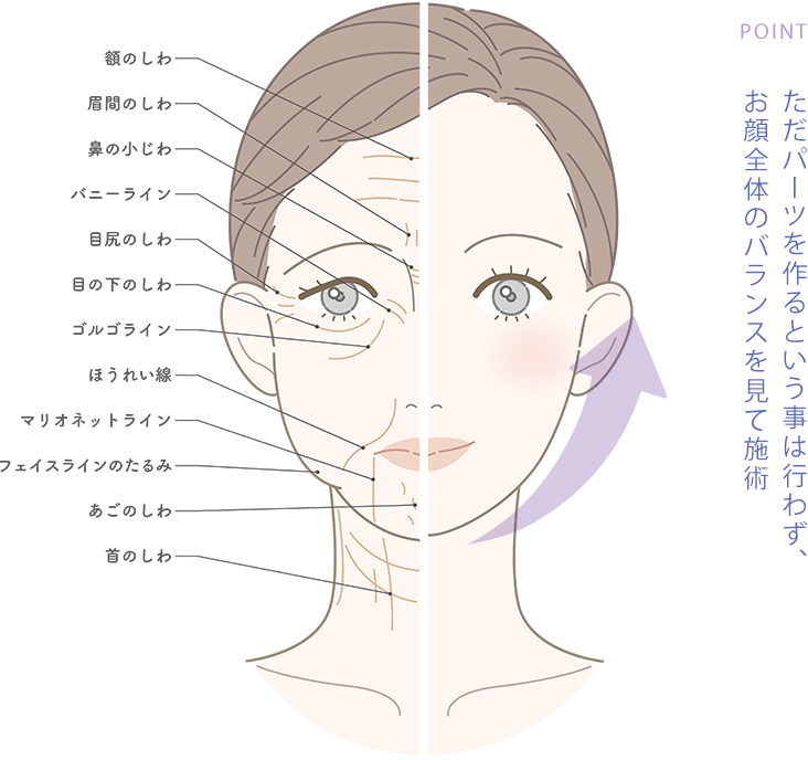 ただパーツを作るという事は行わず、お顔全体のバランスを見て施術