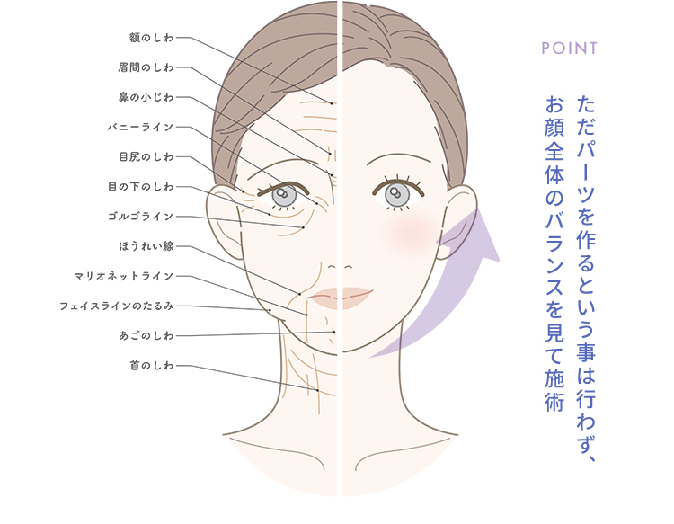 ただパーツを作るという事は行わず、お顔全体のバランスを見て施術