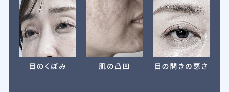 【目のくぼみ】【肌の凹凸】【目の開きの悪さ】